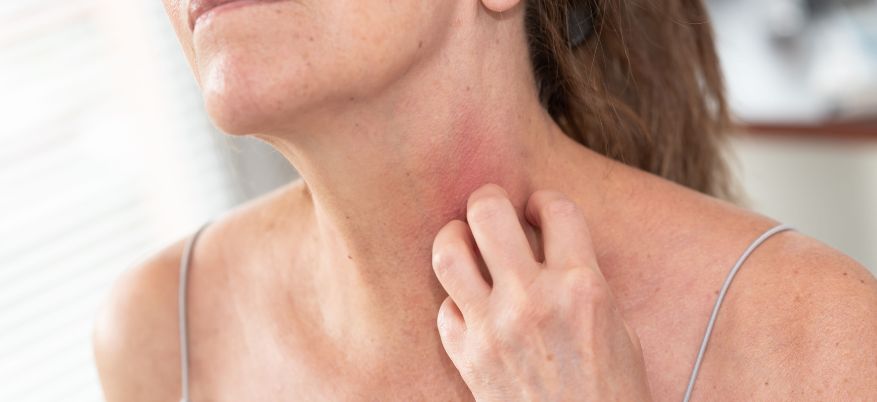 Eczema cutaneo: cause scatenanti, sintomi e rimedi